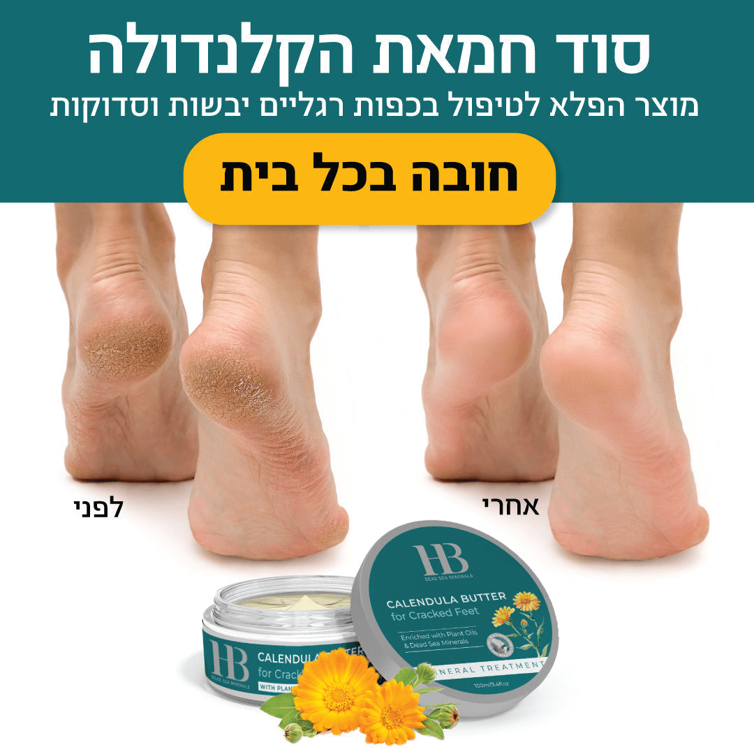 חמאת קלנדולה לרגליים סדוקות | קרם רגליים